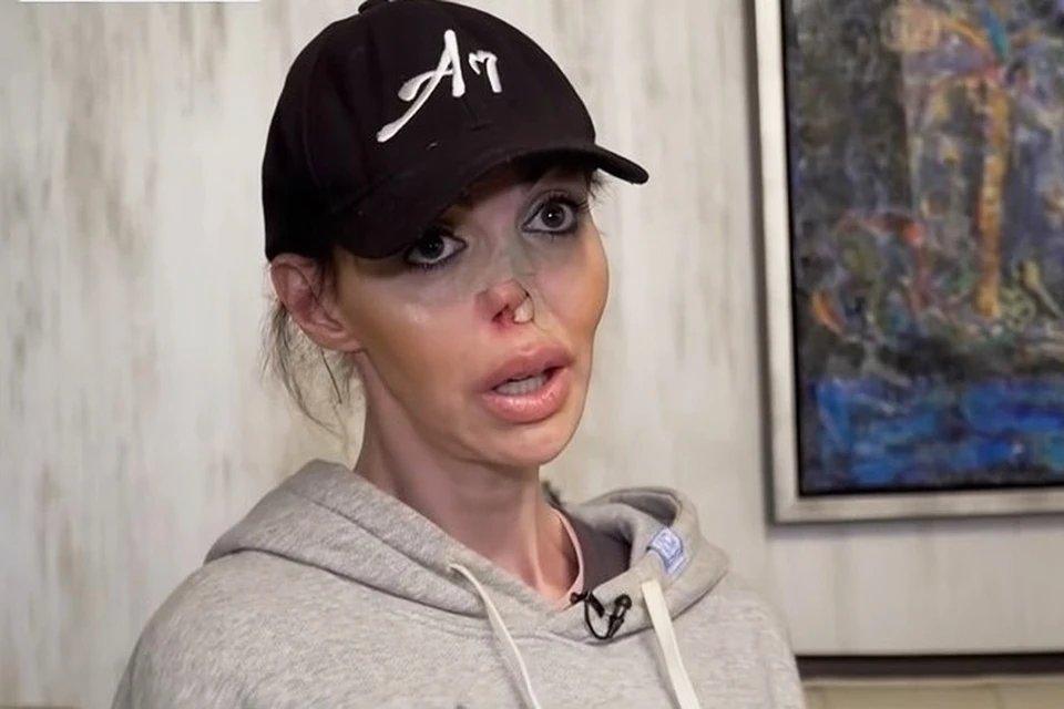 Алиса Аршавина без носа