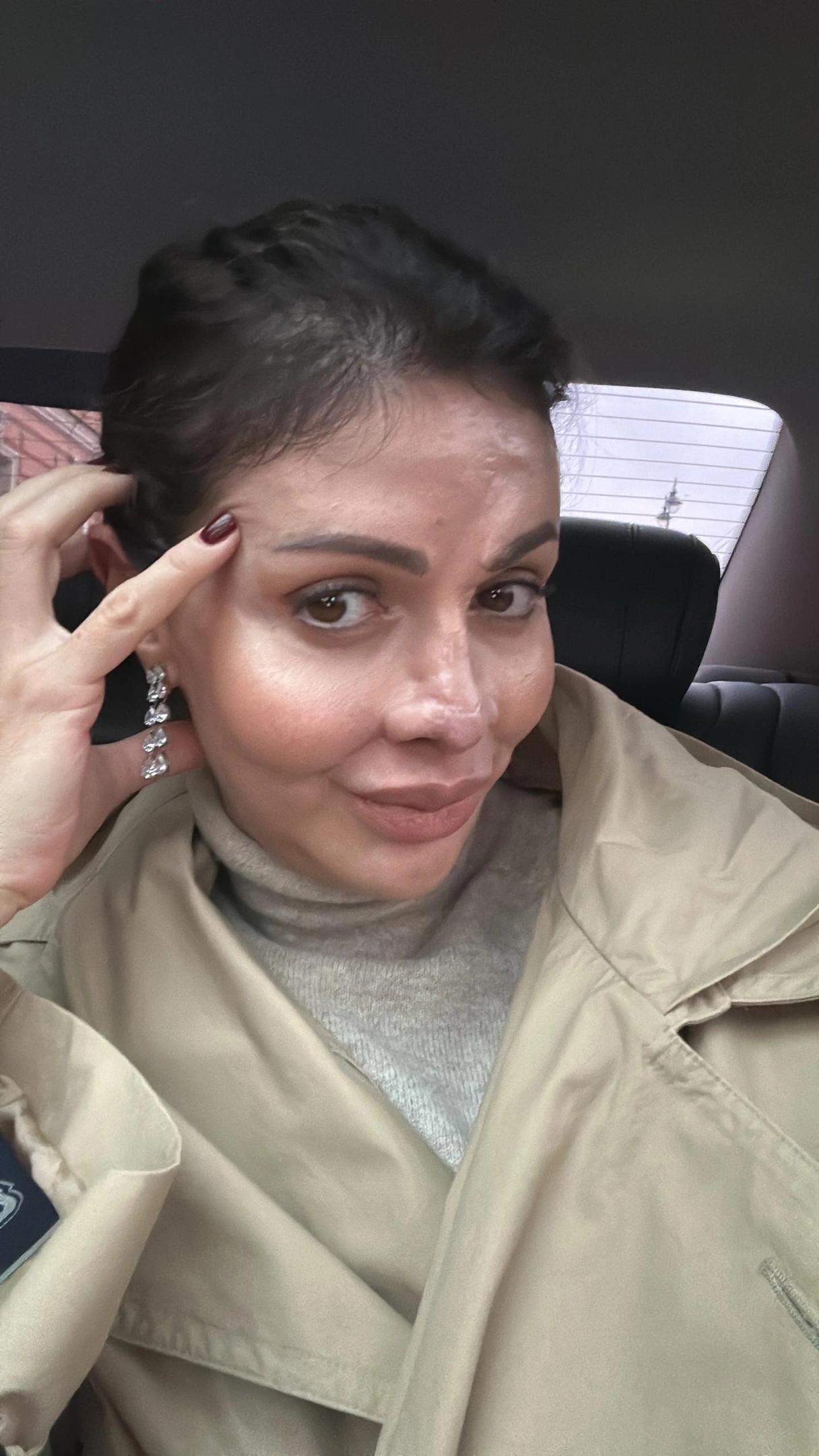 Алиса Аршавина восстановила нос