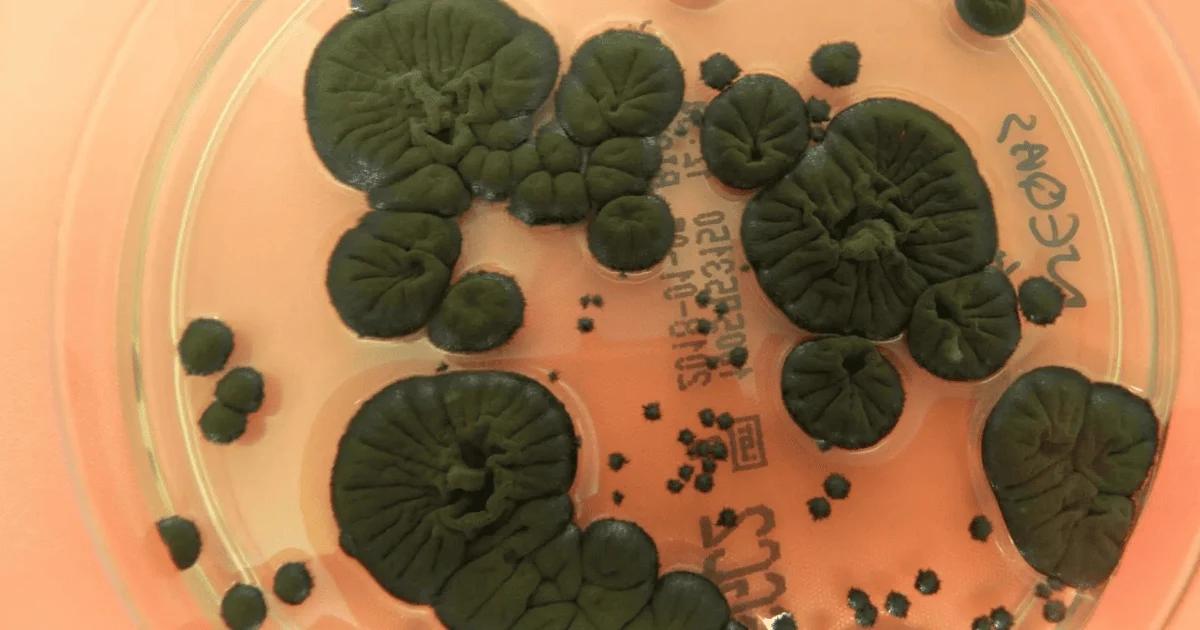 Cladosporium sphaerospermum